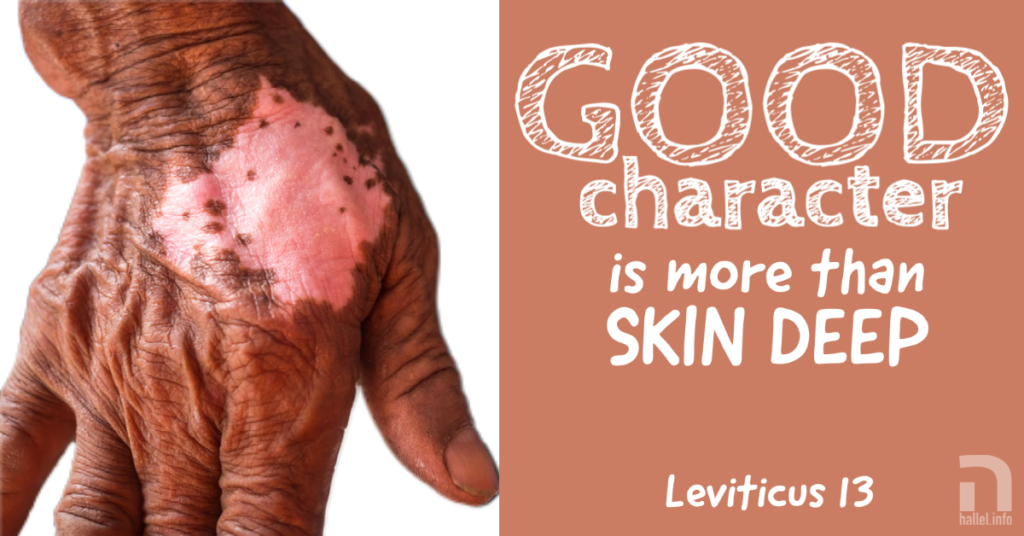Good character is more than skin deep (Leviticus 13)